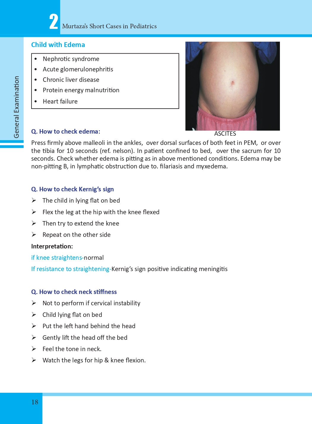 Murtaza’s Short Cases in Pediatrics 2nd Edition (Revised) information image