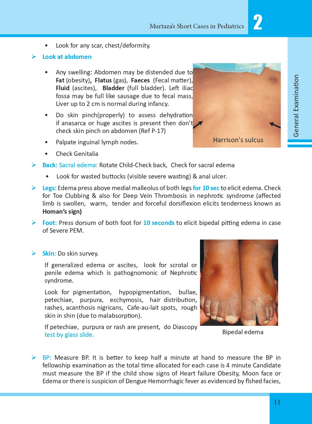Murtaza’s Short Cases in Pediatrics 2nd Edition (Revised) information image